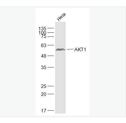 Anti-AKT1 antibody- 蛋白激酶B抗体,AKT1