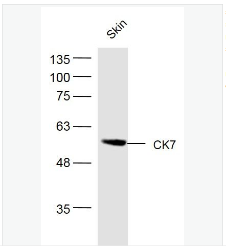 Anti-CK7 antibody- 細胞角蛋白7抗體,CK7