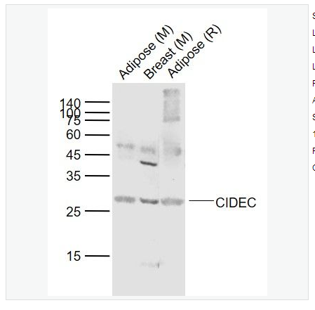 Anti-CIDEC antibody- 细胞死亡活化蛋白抗体,CIDEC