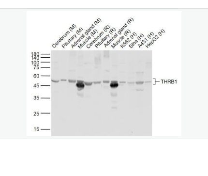 Anti-THRB1 antibody- 甲状腺激素受体β抗体,THRB1