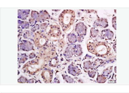 Anti-HPV16 E7 antibody- 人类乳头状瘤病毒16-E7抗体,HPV16 E7
