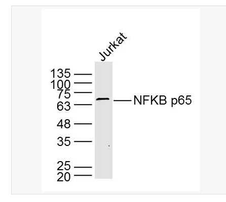 Anti-NFKB p65 antibody- 细胞核因子/k基因结合核因子单克隆抗体,NFKB p65