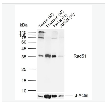 Anti-Rad51 antibody- Rad51重组兔单克隆抗体,Rad51