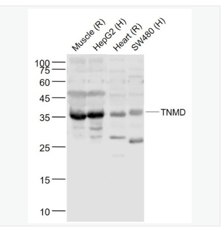 Anti-TNMD antibody- 腱調(diào)蛋白/軟骨調(diào)節(jié)素樣1蛋白抗體,TNMD