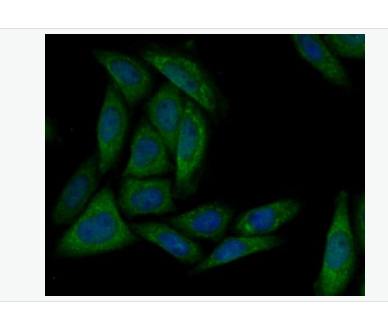 Anti-MARK3 antibody- 兔抗磷酸化絲氨酸/蘇氨酸蛋白激酶MARK3單克隆抗體,MARK3