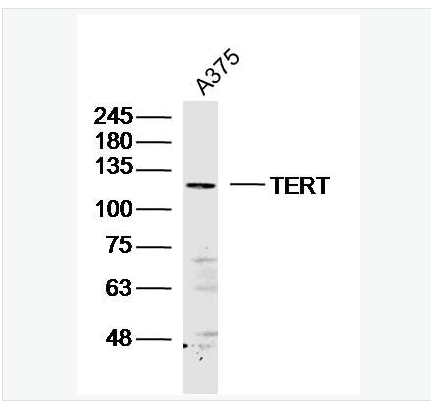 Anti-TERT antibody- 端粒酶反转录酶抗体,TERT