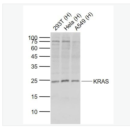 Anti-KRAS antibody- 原癌基因K-ras抗体,KRAS