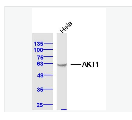 Anti-AKT1 antibody - 蛋白激酶B抗體,AKT1