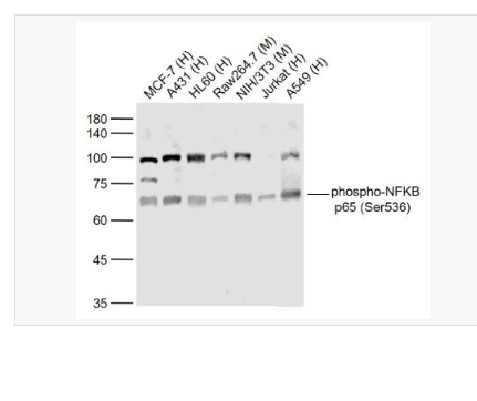 Anti-phospho-NFKB p65 - 磷酸化細(xì)胞核因子抗體,phospho-NFKB p65 (Ser536)