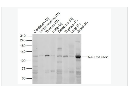 Anti-NALP3/CIAS1 antibody- 细胞凋亡诱导蛋白NALP3抗体,NALP3/CIAS1