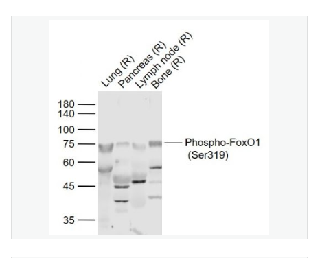 Anti-Phospho-FoxO1- 磷酸化叉头蛋白家族1(Ser319)抗体,Phospho-FoxO1 (Ser319)