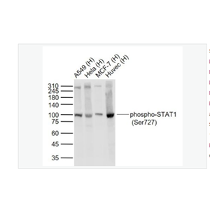 Anti-phospho-STAT1-磷酸化信号转导与转录激活因子1重组兔单克隆抗体