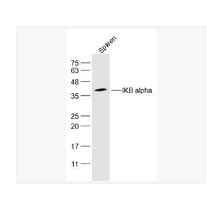 Anti-IKB alpha antibody-核因子κB抑制蛋白α抗体