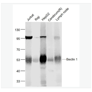 Anti-Beclin 1 antibody-自噬效应蛋白Beclin 1单克隆抗体