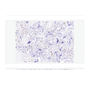 Anti-CD163 antibody -CD163重组兔单克隆抗体