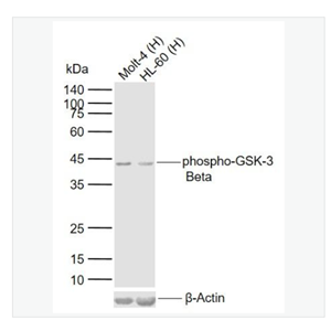 Anti-phospho-GSK-3 Beta -磷酸化糖原合酶激酶-3β单克隆抗体