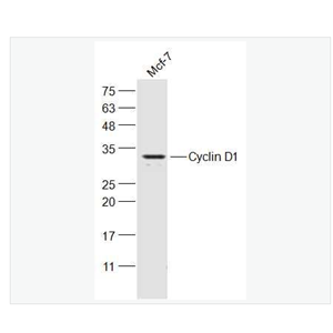Anti-Cyclin D1 antibody -周期素D1抗体