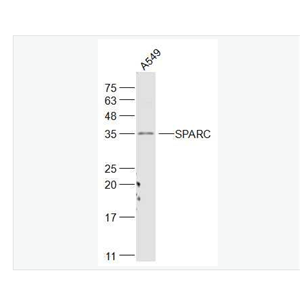 Anti-SPARC antibody -富含半胱氨酸的酸性分泌蛋白抗体,SPARC