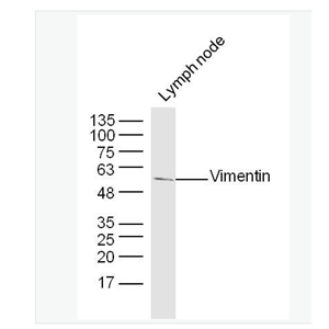 Anti-Vimentin antibody- 波形蛋白抗体
