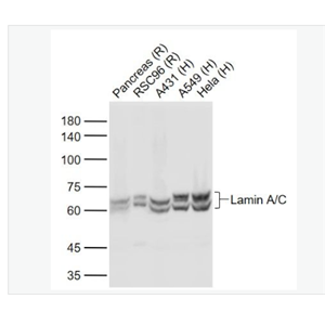 Anti-Lamin A/C antibody- 核纤层蛋白A抗体