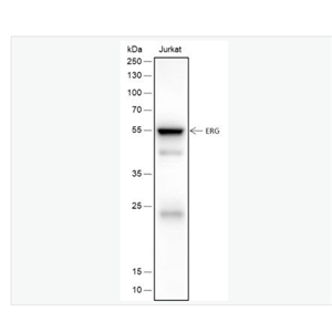 Anti-ERG antibody- 癌基因ERG重组兔单克隆抗体,ERG