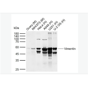 Anti-Vimentin antibody - 波形蛋白抗体,Vimentin
