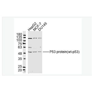 Anti-P53 protein- 肿瘤抑制基因P53蛋白/野生型P53抗体
