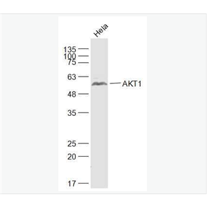 Anti-AKT1 antibody- 蛋白激酶B抗体