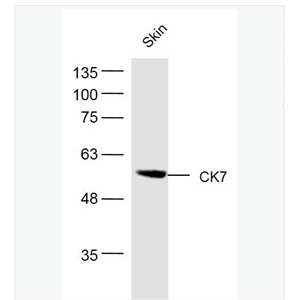 Anti-CK7 antibody- 细胞角蛋白7抗体