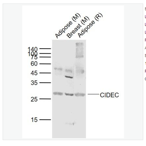 Anti-CIDEC antibody- 细胞死亡活化蛋白抗体