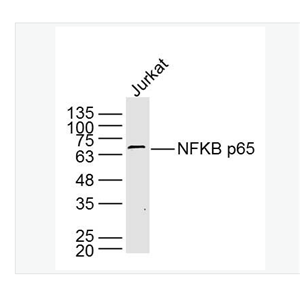 Anti-NFKB p65 antibody- 细胞核因子/k基因结合核因子单克隆抗体,NFKB p65