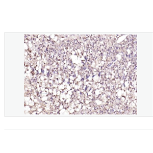 Anti-PPM1D antib- 原癌基因WIP1抗体