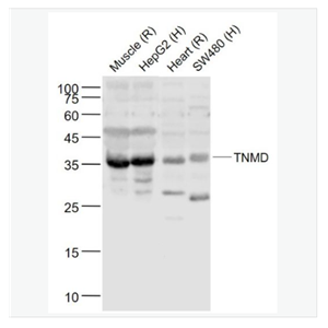 Anti-TNMD antibody- 腱调蛋白/软骨调节素样1蛋白抗体