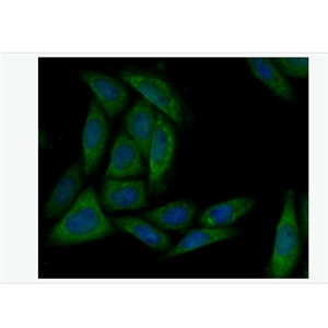 Anti-MARK3 antibody- 兔抗磷酸化丝氨酸/苏氨酸蛋白激酶MARK3单克隆抗体