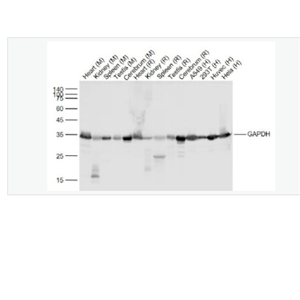 Anti-GAPDH- 3-磷酸甘油醛脱氢酶（内参）重组兔单克隆抗体