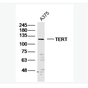 Anti-TERT antibody- 端粒酶反转录酶抗体,TERT