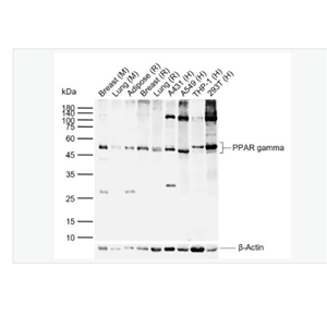 Anti-PPAR gamma antibody - 过氧化酶活化增生受体γ抗体