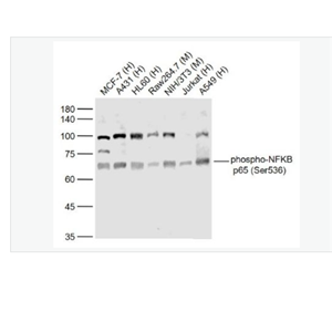 Anti-phospho-NFKB p65 - 磷酸化细胞核因子抗体