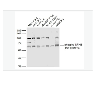 Anti-phospho-NFKB p65 - 磷酸化細(xì)胞核因子抗體,phospho-NFKB p65 (Ser536)