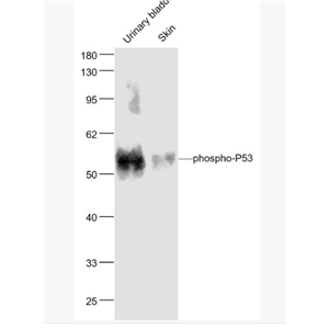 Anti-phospho-P53 - 磷酸化肿瘤抑制基因P53抗体,phospho-P53 (Ser33)