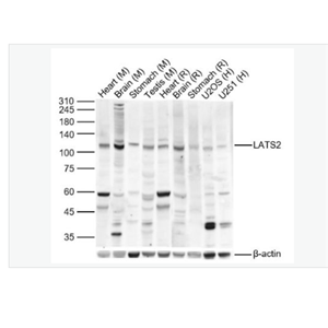 Anti-LATS2 antibody- 肿瘤抑制基因LATS2抗体,LATS2