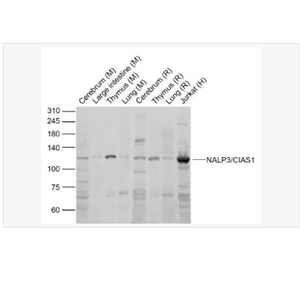 Anti-NALP3/CIAS1 antibody- 细胞凋亡诱导蛋白NALP3抗体,NALP3/CIAS1