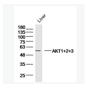 Anti-AKT1+2+3 antibody- 蛋白激酶AKT1,2,3抗体