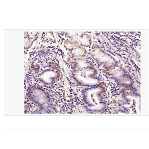 Anti-phospho-Smad3- 磷酸化细胞信号转导分子SMAD3抗体