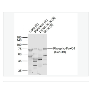 Anti-Phospho-FoxO1- 磷酸化叉头蛋白家族1(Ser319)抗体,Phospho-FoxO1 (Ser319)