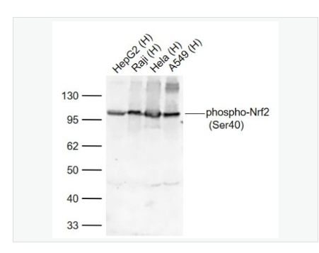 Anti-CK16 antibody- 细胞角蛋白16单克隆抗体磷酸化核因子2相关因子2(Ser40)重组兔单克隆抗体,phospho-Nrf2 (Ser40)