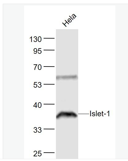 Anti-Islet-1 antibody- 胰岛素基因增强结合蛋白1抗体,Islet-1