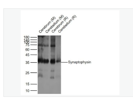 Anti-Synaptophysin antibody- 突触小泡蛋白P38重组兔单克隆抗体,Synaptophysin