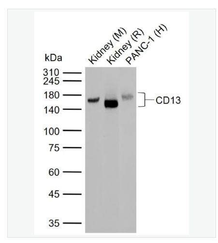 Anti-CD13 antibody- CD13重組兔單克隆抗體,CD13