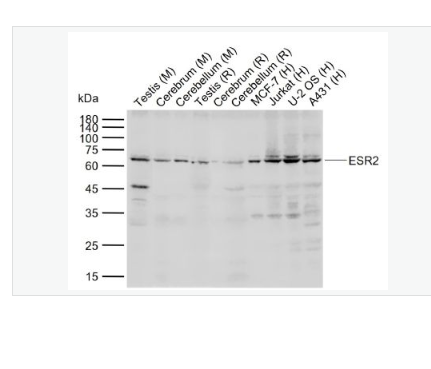 Anti-ESR2 antibody- 雌激素受體β抗體,ESR2